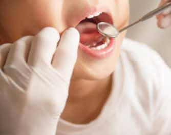 Dentista Clinica Dental Alvarado estepona