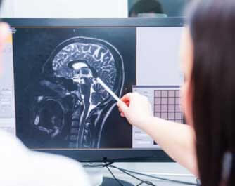 Neurólogo Servicio De Radiodiagnóstico Resonancia Magnética Y Tc Hospital Nuestra Señora Del Rosario Madrid madrid